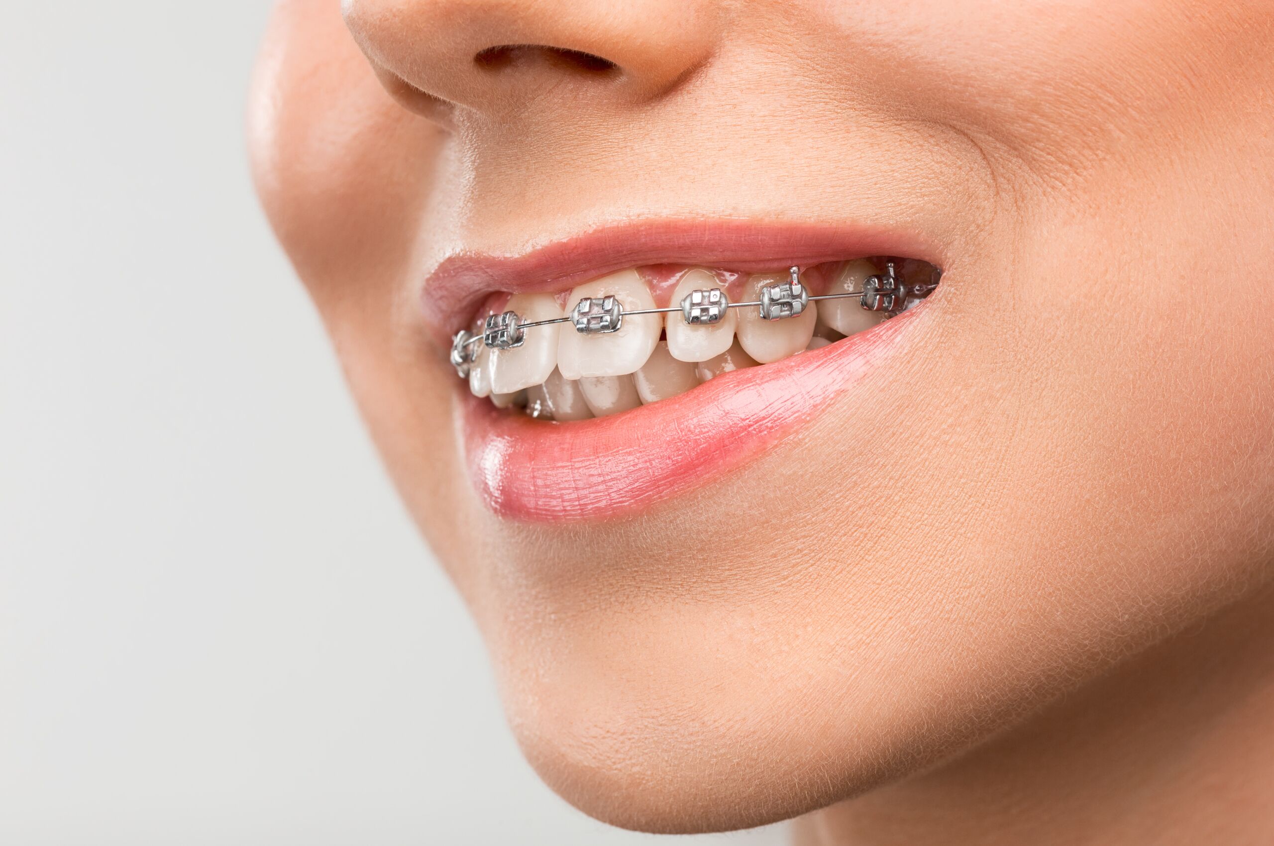 Chagrin Falls Invisalign